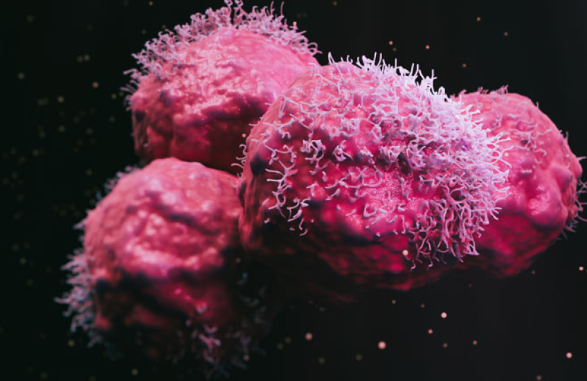 Illustration of malignant cancer cells 