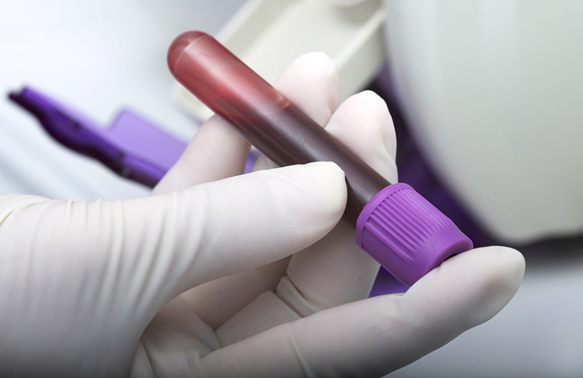 blood test