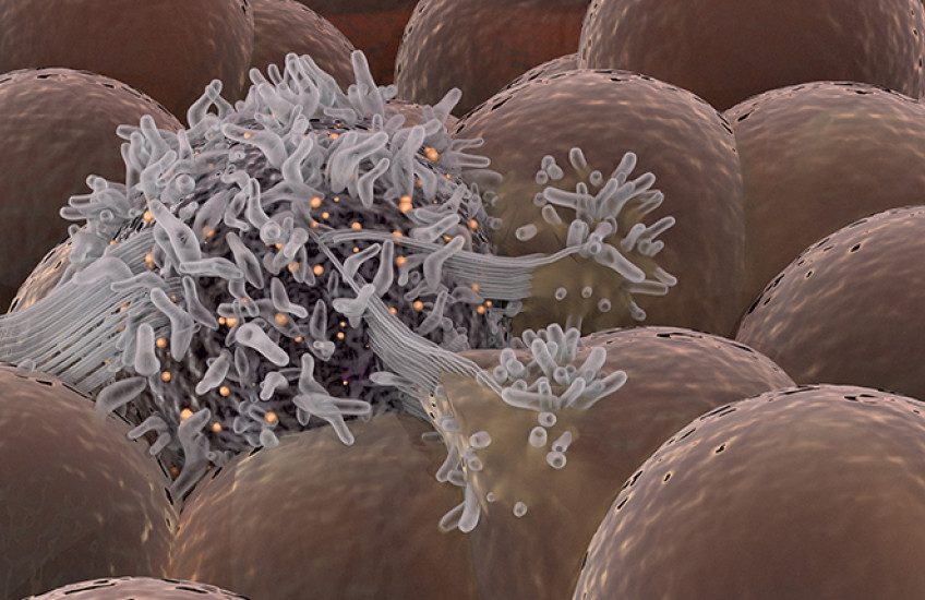 cancer cell