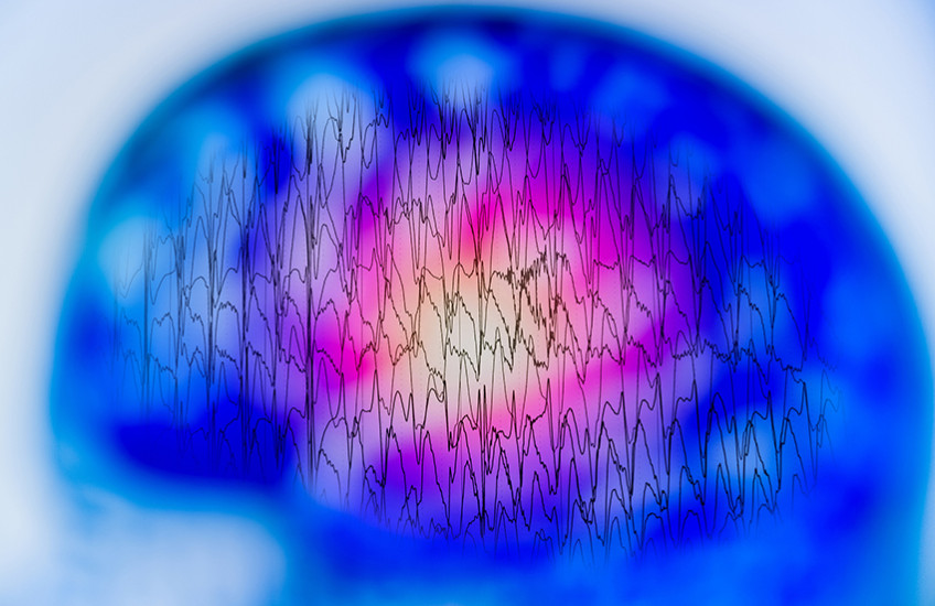 brain eeg