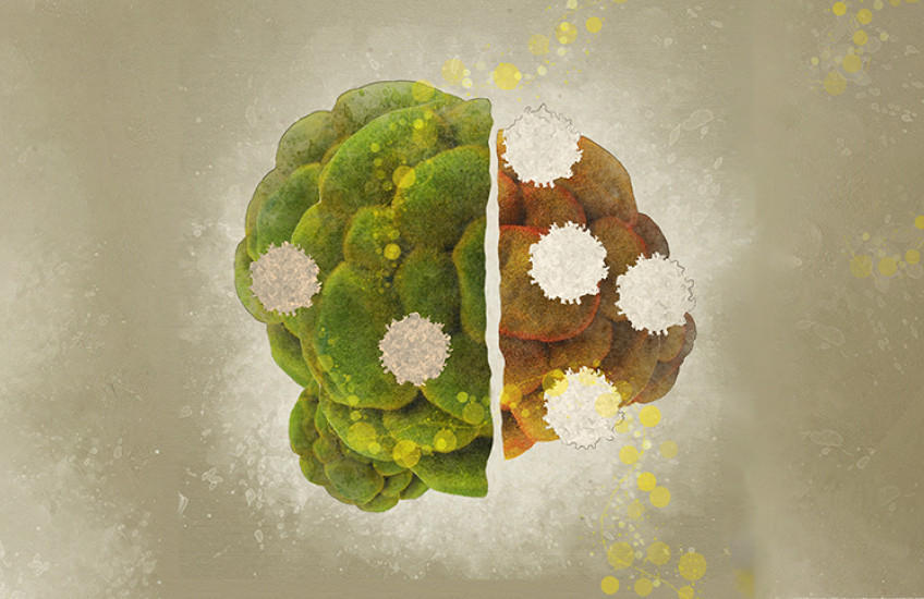 tumor obese vs nonobese