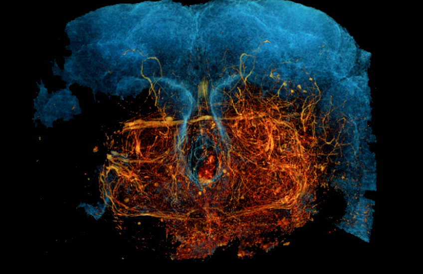xnh brain