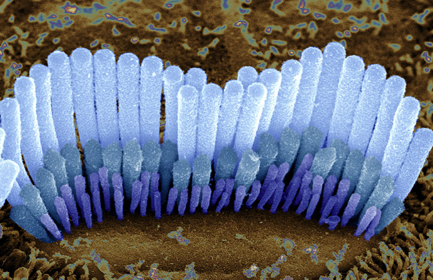 hair cells