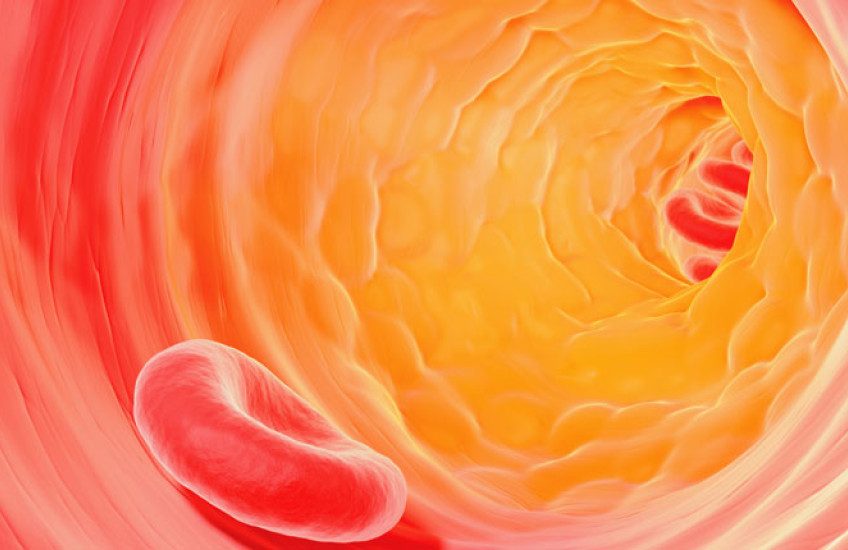 Illustration of the inside of an artery with plaque buildup 