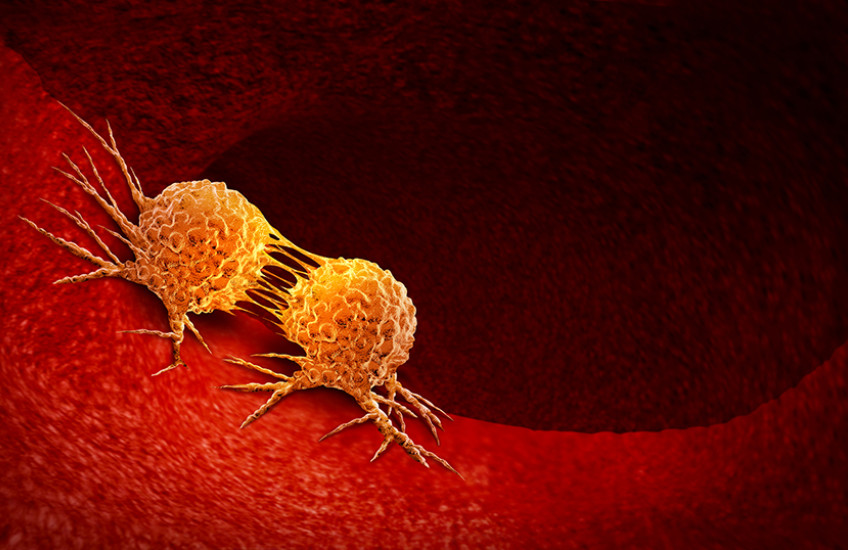 cancer cells