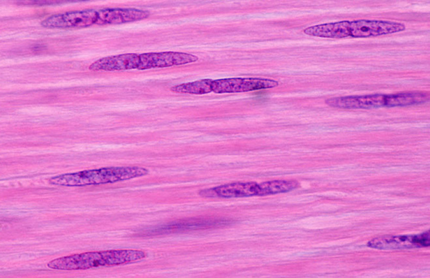 Photo of smooth muscle cells 