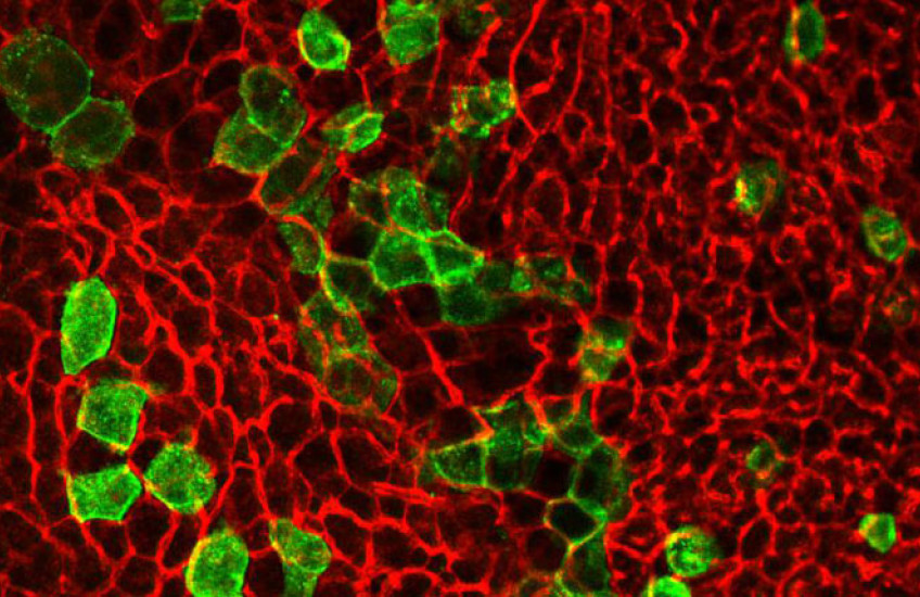 Photo of Brown adipocytes derived from progenitors expressing the Trpv1 receptor. 