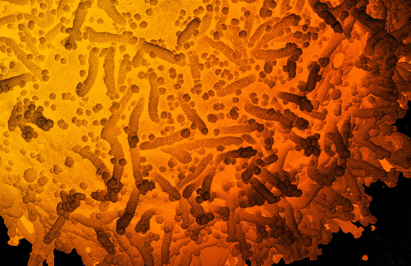 Colored electron micrograph shows a cell swarmed with small viral particles