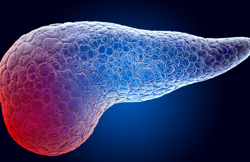 illustration of pancreas in blue and red; the red is meant to show pain
