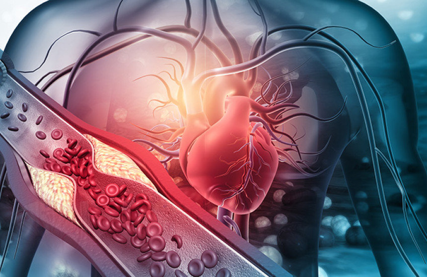 digital image of heart and blocked arterty