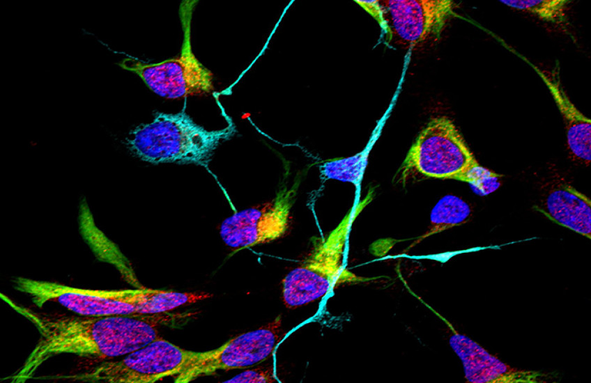 Neurons in blue and turquoise stand out against neurons in pink and green