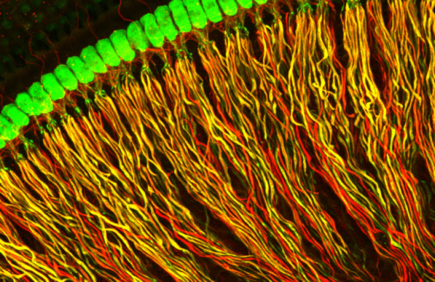 Spiral ganglion neurons