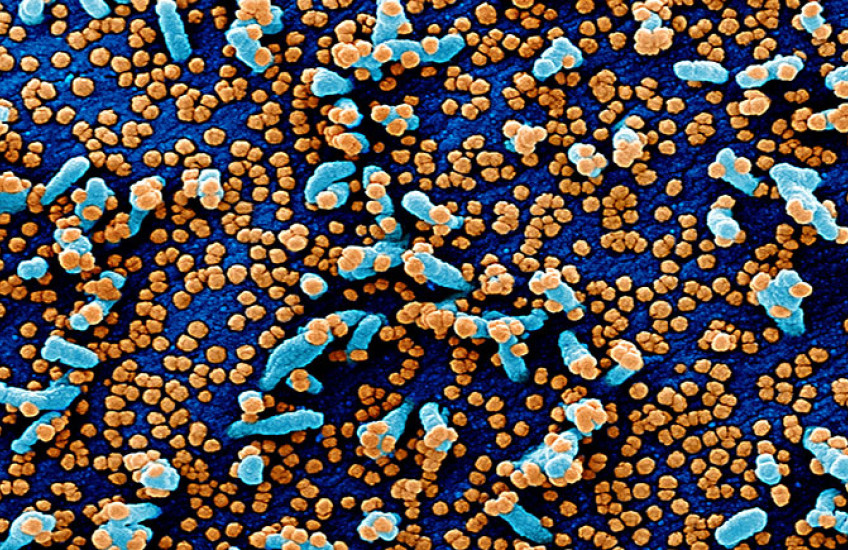 Image of SARS-CoV-2 magnified