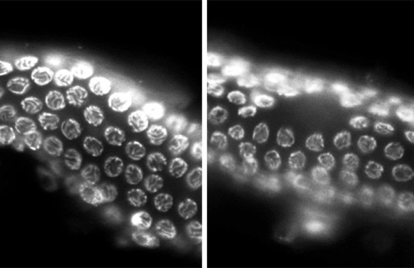 Egg cells in a worm shown as normal (left) and with a gap (right)
