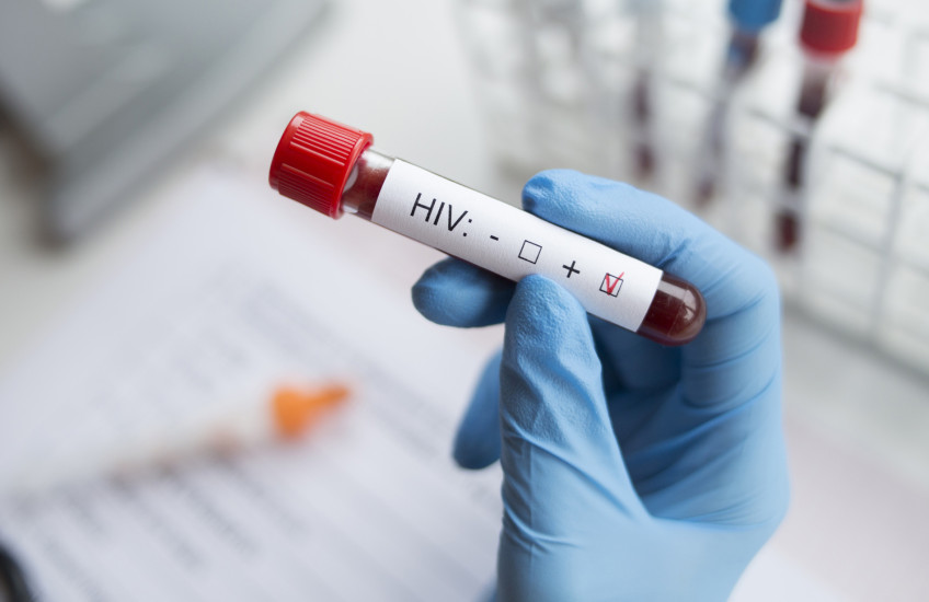 Photo of a gloved hand grasping a blood-test tube labeled "HIV+"; hand is wearing a blue medical glove; background is blurred blood-test tubes and notebook