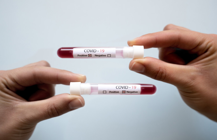 Two hands, each holding a covid-19 blood test, one negative, one positive