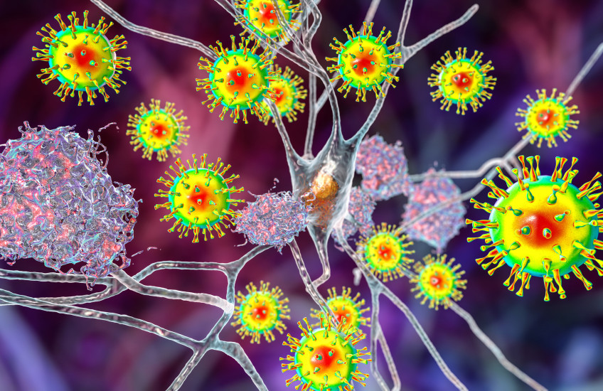 3D illustration of neuropsychiatric effects of covid; bright yellow, red, blue, and green spike proteins on purple background
