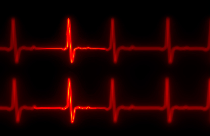 Two horizontal red lines punctuated with jagged peaks representing a heart beat on an electrocardiogram