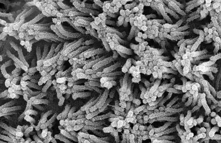 Black and white microscope image shows dozens or hundreds of tube-like projections aligned in different directions