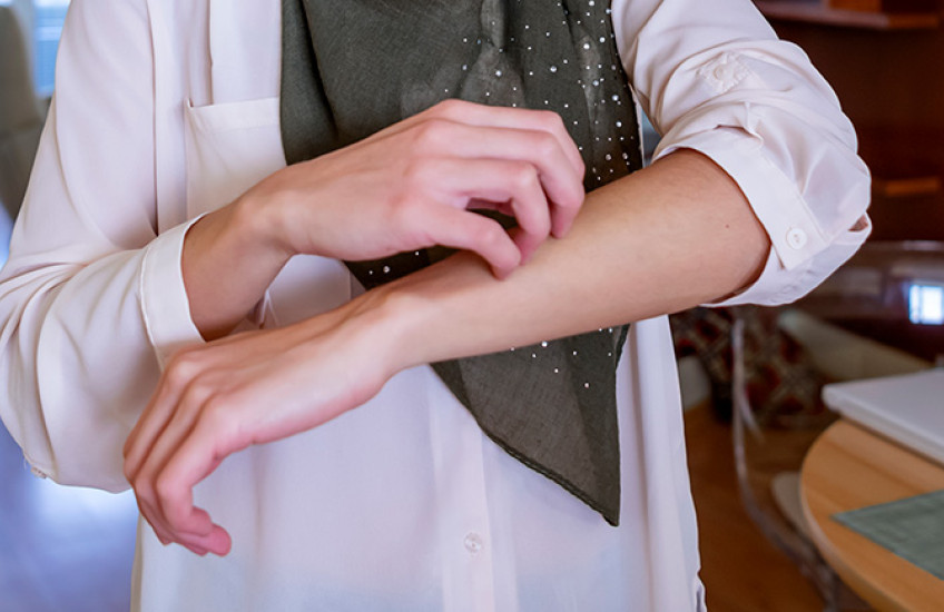 Muslim woman with 3/4 length sleeves scratching arm; image cropped to just show torso