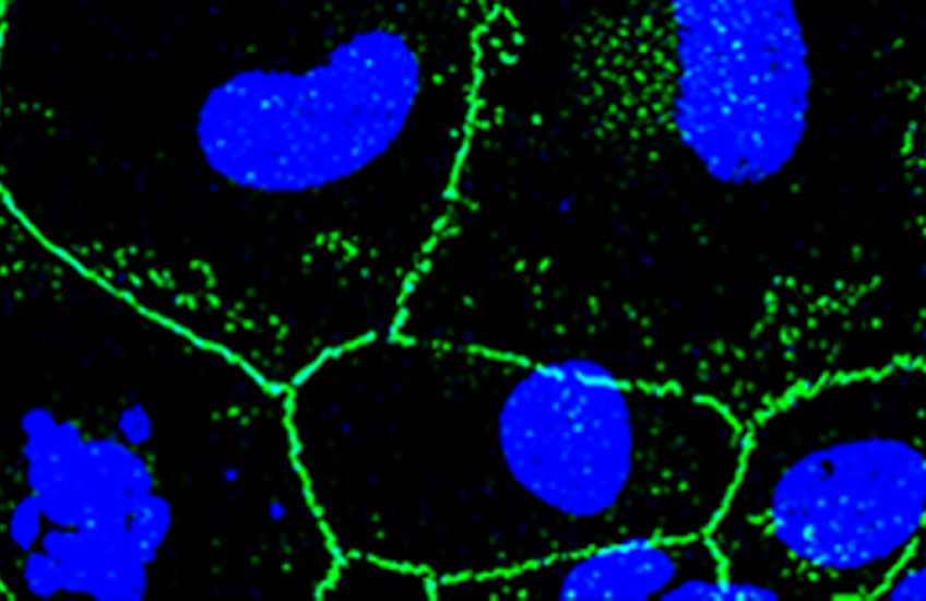 Confocal microscopy image of a whole mount of female mouse CE at 3 months post 500 J/cm2 UVA (green: ZO-1 staining (tight membrane junctions); blue: nuclear staining using DAPI)