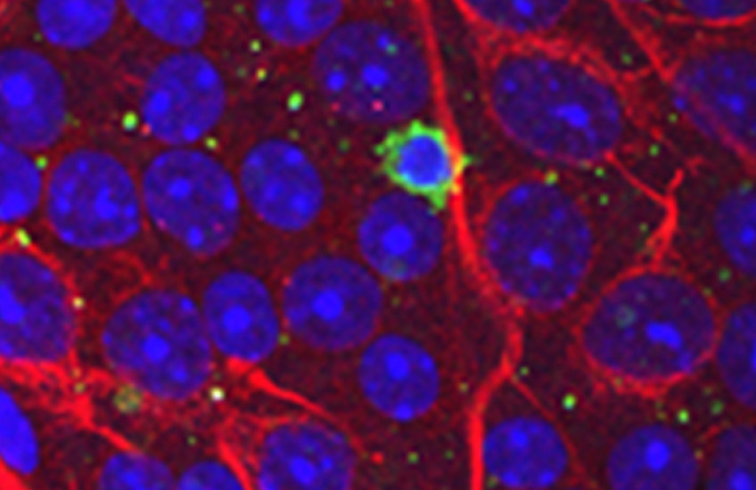 Elevated eye pressure can cause T cells, shown in green, to infiltrate the eye and attack neurons