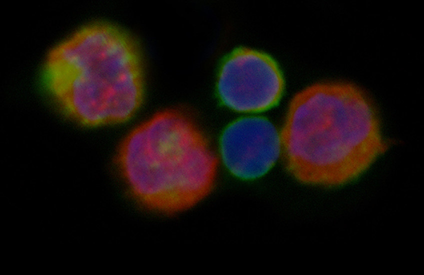 T cells glow blue, red and yellow