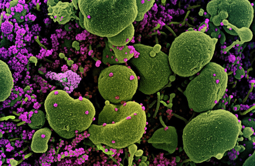 microscopic image of SARS-CoV-2