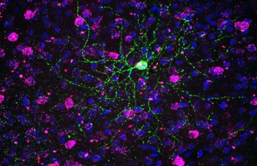 Colorized micrograph shows web of green tendrils emanating from a nucleus against a backdrop of puple nuclei on black