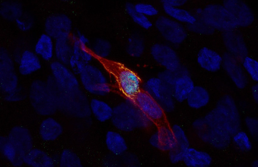 an elongated cell glows orange around the edges against a dark background in a fluorescently-tagged microscope image