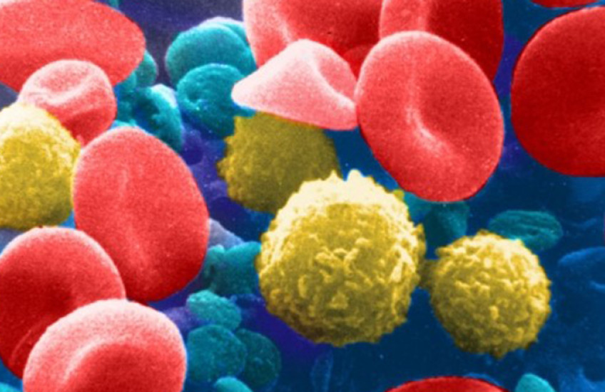 Micrograph of disc-shaped red blood cells and ball-shaped white blood cells on colorized blue background