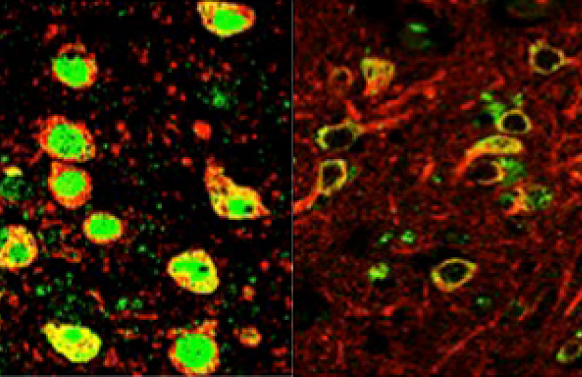 Side by side microscopy images with REST protein in fluorescent green
