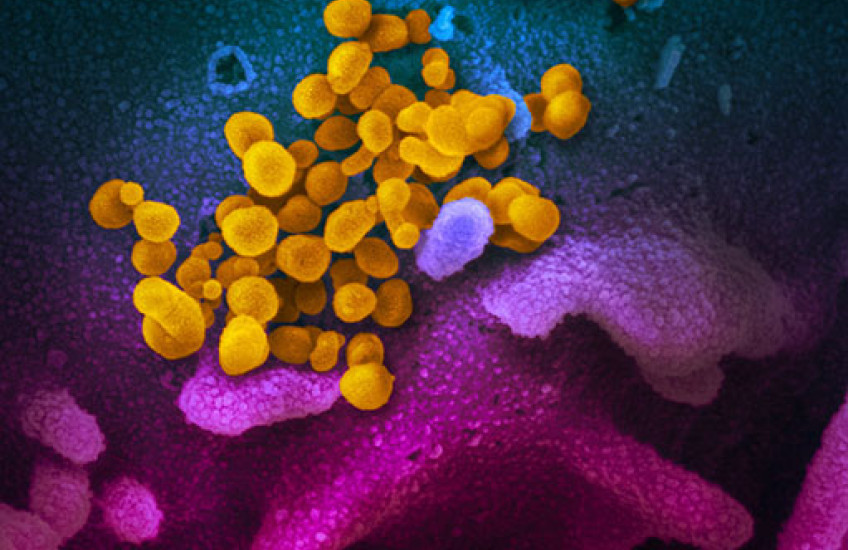 Scanning electron microscopy of new coronavirus