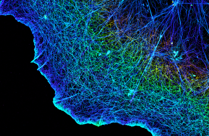 Fluorescent dye lights up actin strings in a cell in a rainbow of colors. The cell edge glows in a shape like a fried egg against a black backdrop.