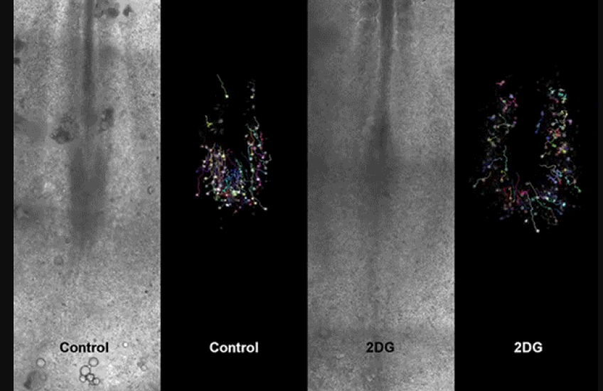 Make Room for Metabolism