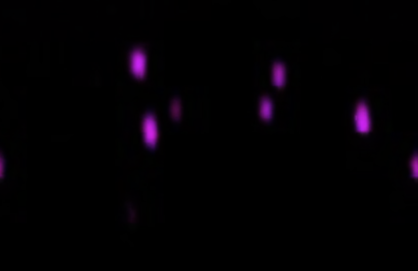 half a dozen blurry magenta dots against a black background