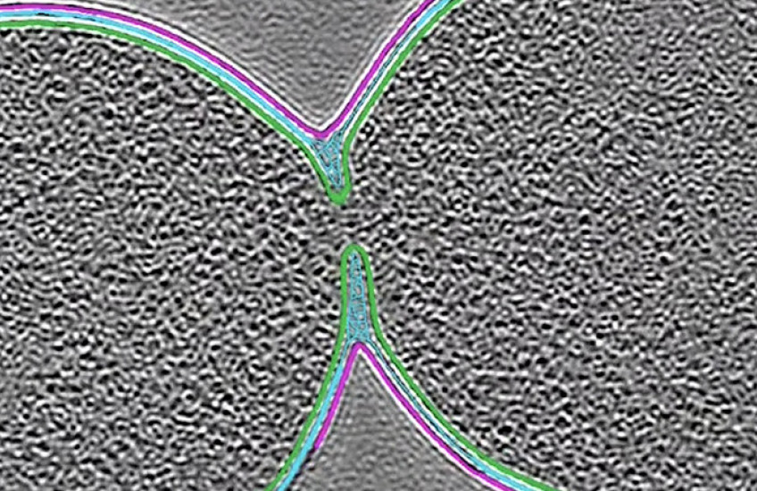 extreme closeup of an E. coli bacterium dividing