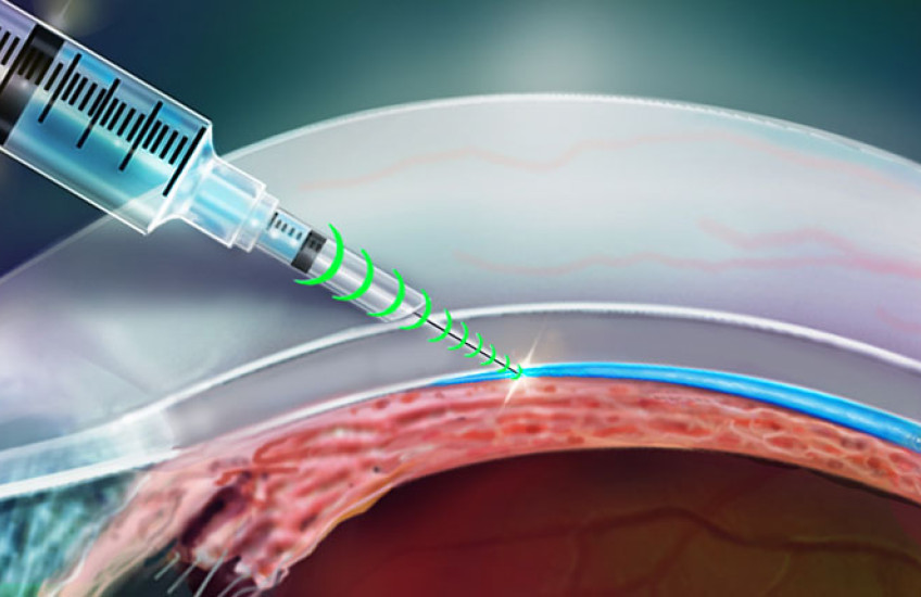 Researchers invent a resistance-sensing injection device that knows where to go