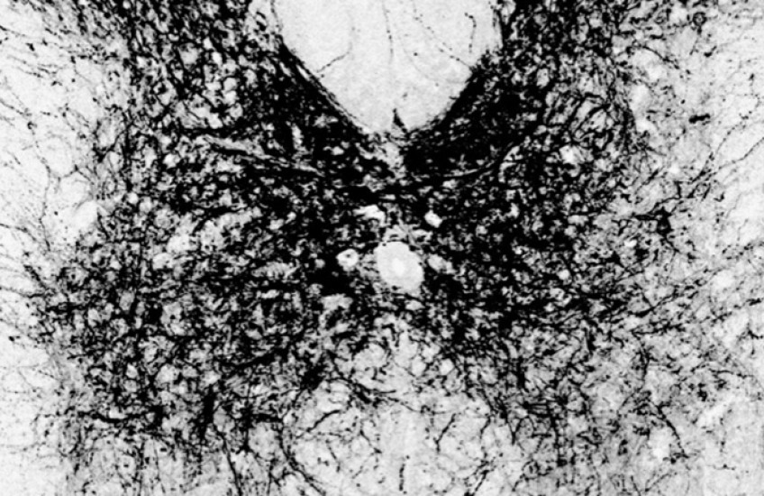 butterfly-shaped microscope image with green dots