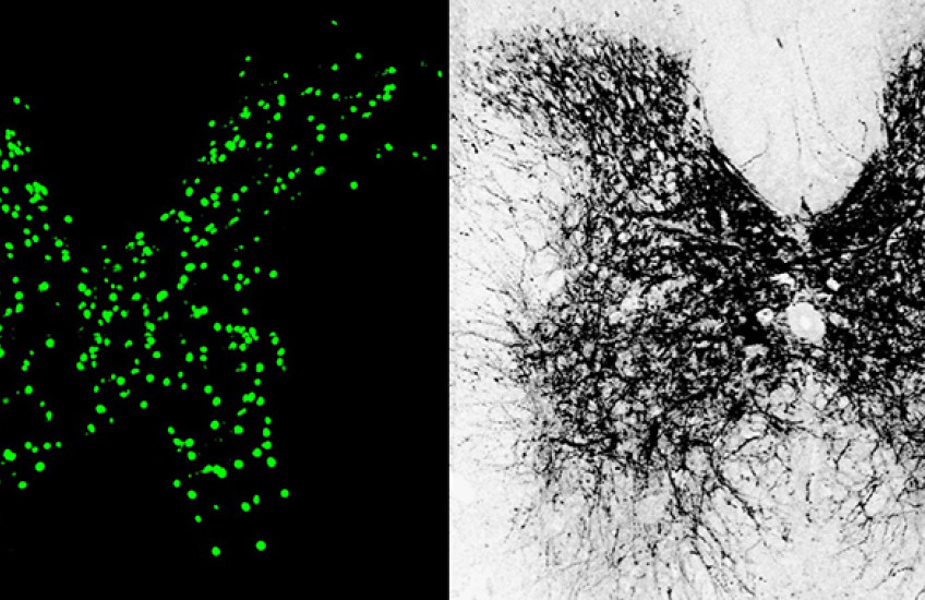 butterfly-shaped microscope image with green dots