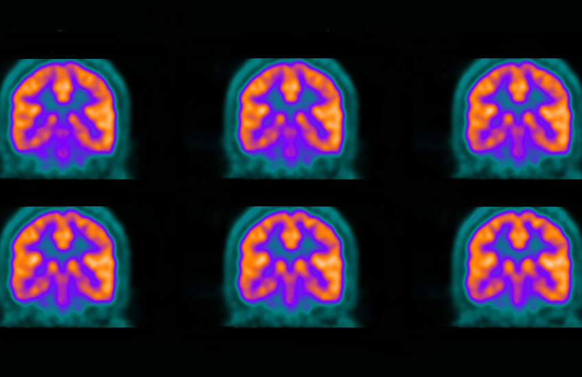 A colorful collage of purple, orange and turquoise images of a brain