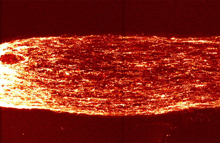 Fiery-looking bundle of nerves is white on the left side and orange-red on the right side against a black ground