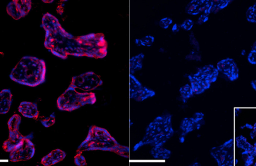 Side by side micrographs show cells lit in purple (left) and blue (right) against a black background