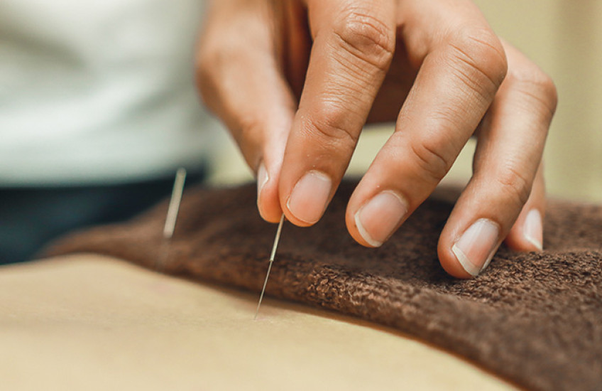 acupuncture needles being inserted in patient 