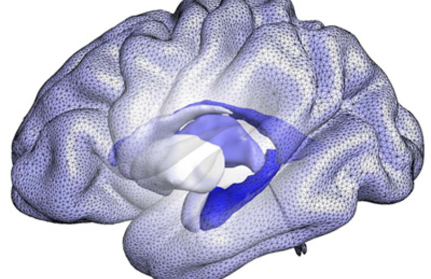 A computational model of brain structures that form the basis of BrainPrint, a system for representing the whole brain based on the shape, rather than the size, of structures. Image: Martin Reuter and Christian Wachinger/Martinos Center for Biomedical Imaging, Mass General