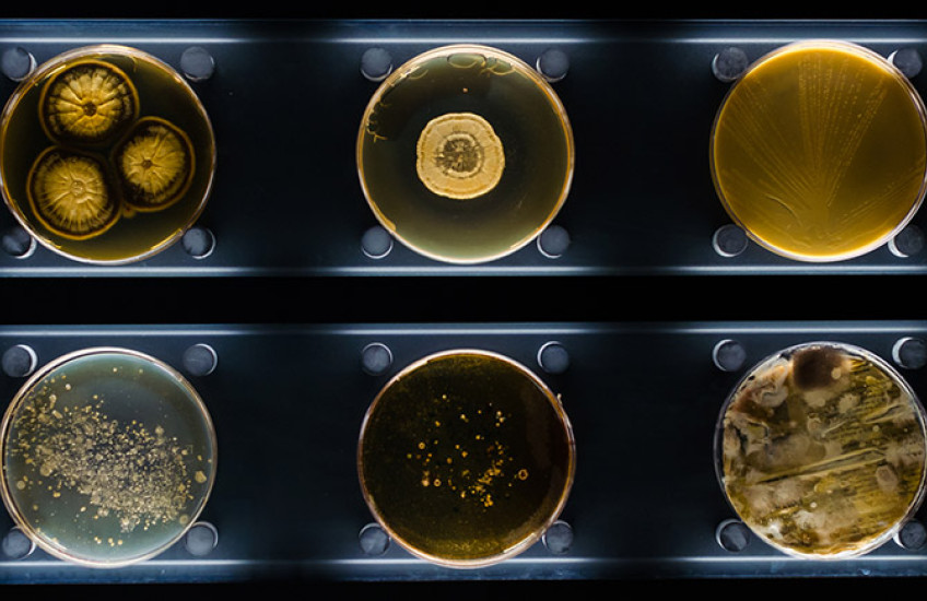 six Petri dishes containing different types of bacteria