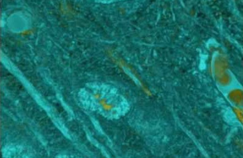 Circuits in the brain 