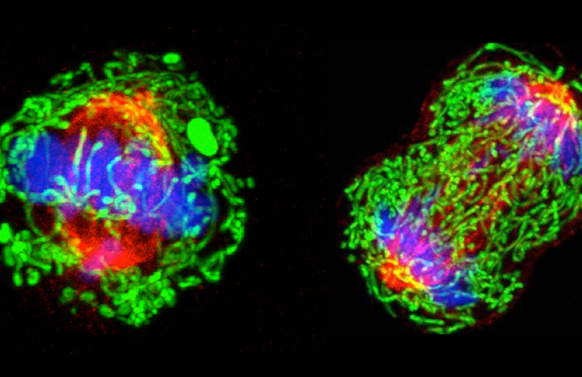 breast cancer cell dividing
