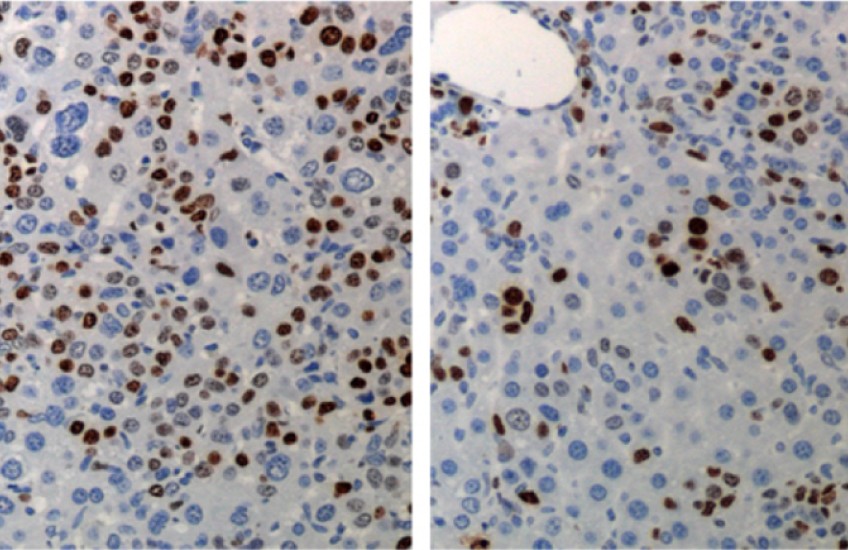 Lung cancer cells are reduced in the treated mouse (right) compared to control mouse (left)