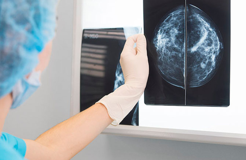 A clinician (a doctor or a nurse) looks at an X-ray scan of breast cancer